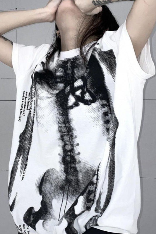 X-Ray Bone Graphic T-Shirt Secondary image